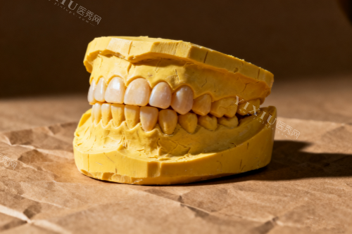 牙齿模型图一览