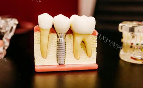 武汉诺洁口腔牙齿模型实拍图