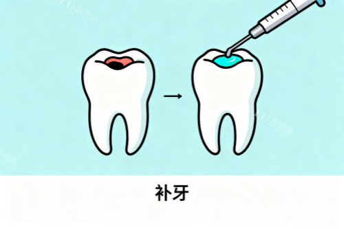 补牙修复展示图