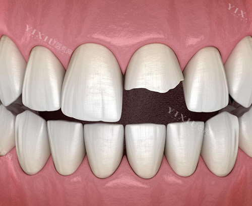 石家庄植美口腔靠谱吗？深度解析其资质、技术、服务，带你放心看牙！(图2)