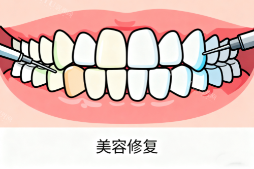 廊坊中诺口腔医院大揭秘！牙齿种植、正畸、修复等项目各品牌具体收费曝光！(图5)