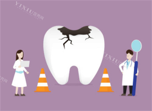 牙齿破损示意图