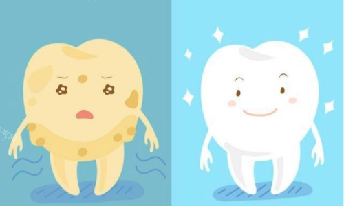 牙齿美白前后对比图