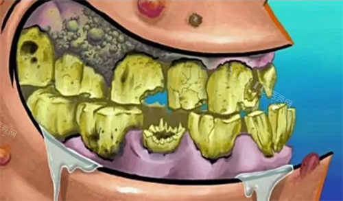 口腔烂牙齿动画展示