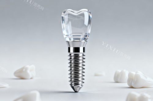 奥齿泰种植牙展示图