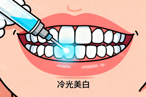 牙齿冷光美白卡通图