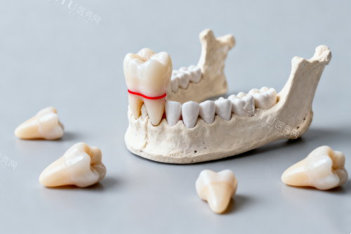 郑州怡仁口腔医院新价目表：拔智齿380元起、金属托槽矫正7900元起、贴面修复2200元起(图8)