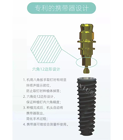 百康特种植牙六角设计优势图片