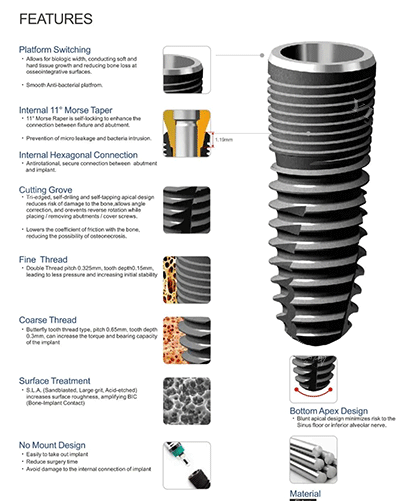 安联种植牙植体细节图片