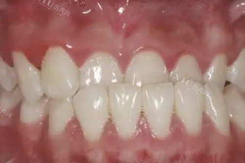 牙齿地包天卡通图