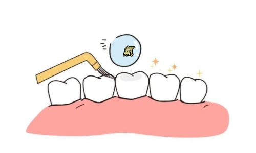 儿童牙齿涂氟动画展示图