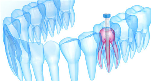 牙齿内部根管透视图