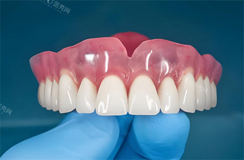 全口种植牙齿图片