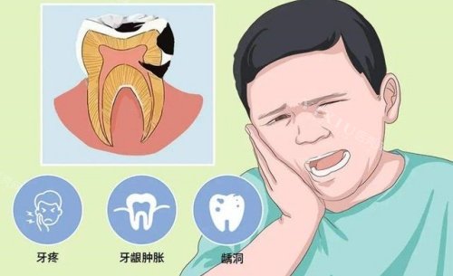 牙齿疾病示意图