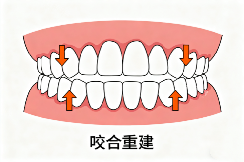 牙齿咬合重建卡通展示图