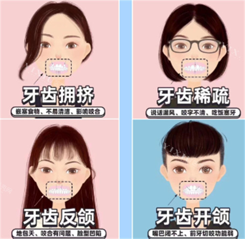 牙齿矫正自查表