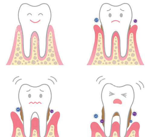延吉哪个牙科好又便宜？牙博士口腔／韩世口腔／朗朗口腔／公园口腔／卓凡口腔必选！(图6)