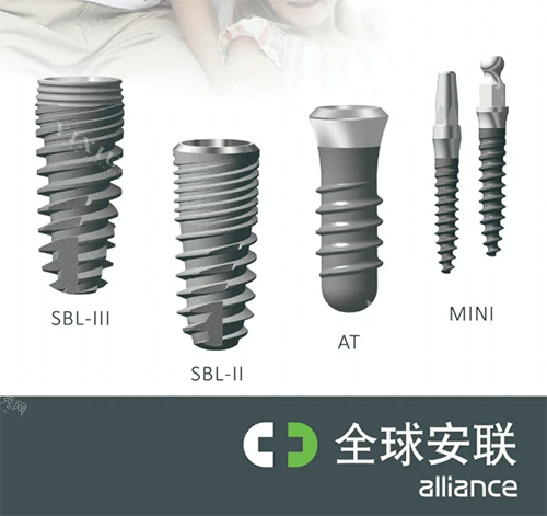 安联种植牙好不好