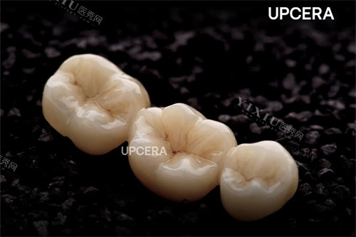 爱尔创-瓷倍健全瓷冠