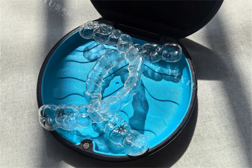 隐适美牙齿矫正