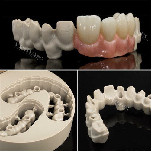 peek支架材料成品展示