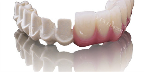 peek支架内部结构展示