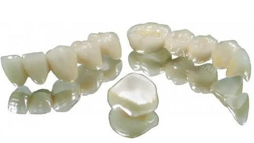 威兰德全瓷牙冠