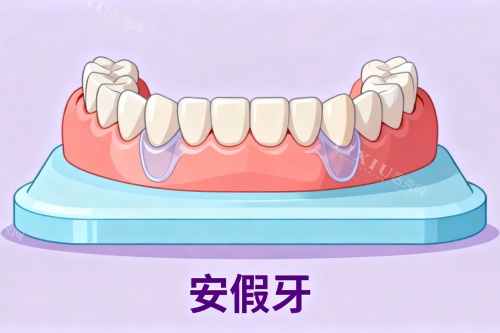 震惊！医生不建议带活动义齿的背后，竟藏着这些鲜为人知的秘密！(图4)