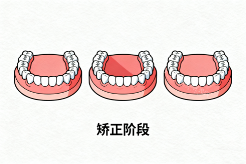 牙齿矫正成果展示