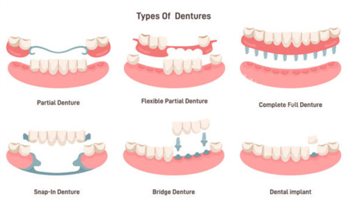 牙齿缺失示意图