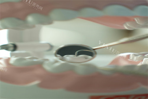 牙齿治疗细节展示