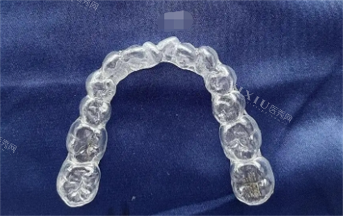 时代天使隐形矫正器