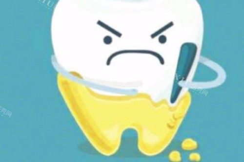 牙齿发黄卡通图