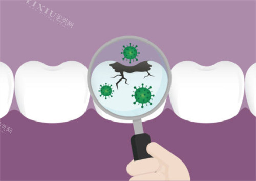 牙齿有疾病示意图