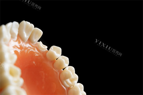 牙齿修复图示