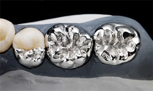 烤瓷牙素材图片