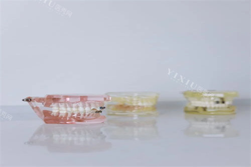 牙齿模型示意展示