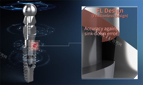 沃兰种植牙植体细节图
