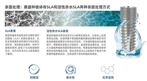 康盛种植牙表面设计图片