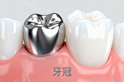 金属牙冠修复卡通图