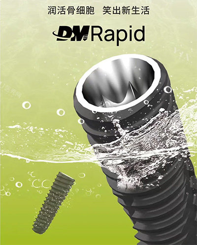 登德玛种植牙照片