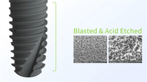 利多齿种植牙材料