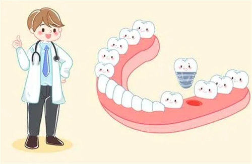 种植牙安装动画图