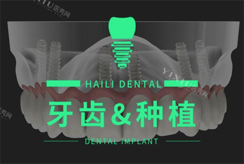 广州海狸口腔种植牙