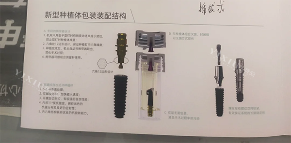百康特种植牙设计结构图片