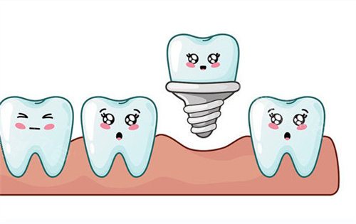 种植牙动画展示图片