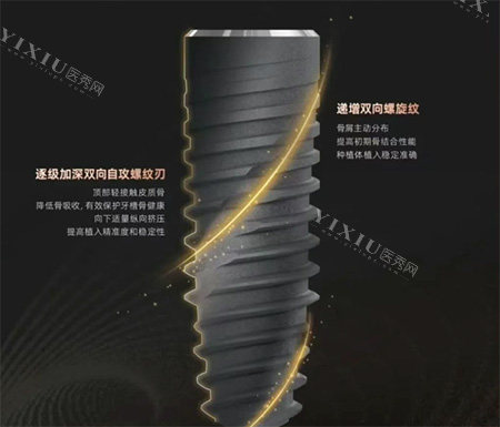 卡尔斯种植牙种植体螺纹照片