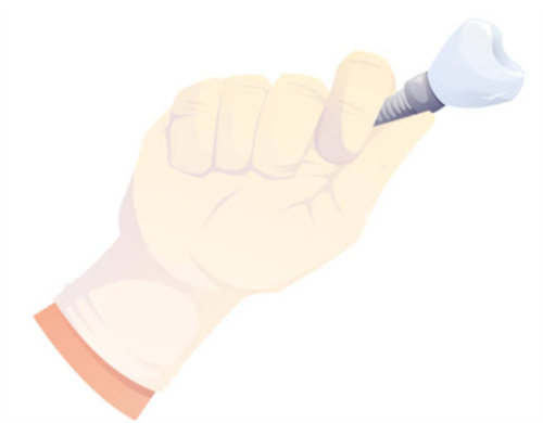 手拿种植牙