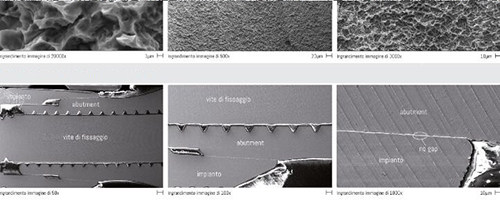 西泰克种植牙表面处理