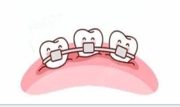 隐形牙齿和传统牙齿矫正器展示图